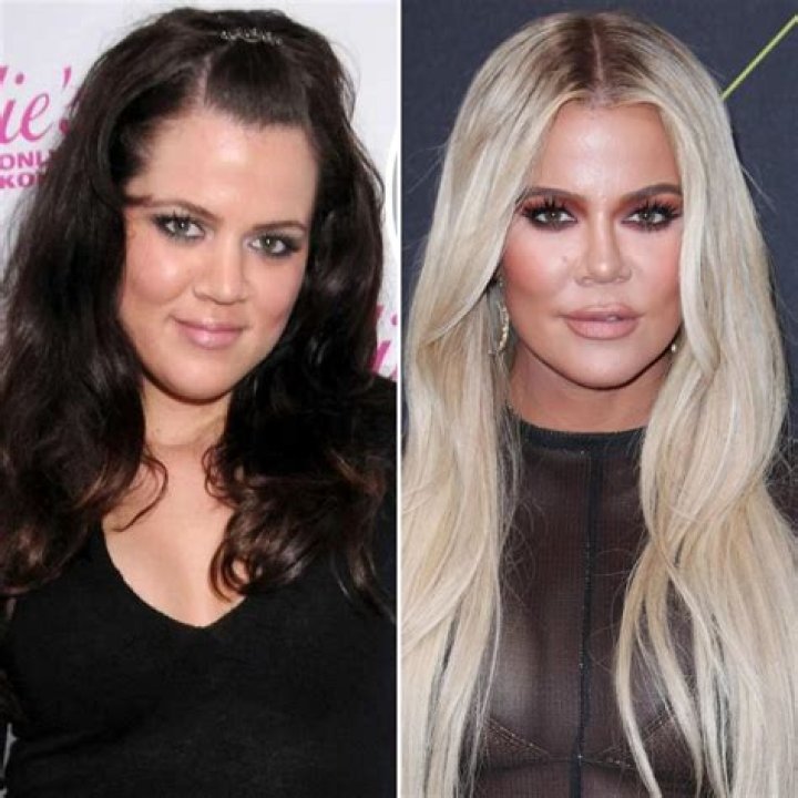 Khloe Kardashian Plastic Surgery: Did She Get A Nose Job?